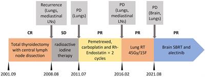 Remarkable response to alectinib for metastatic papillary thyroid cancer with STRN-ALK fusion: A case report